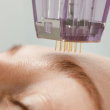 MICRONEEDLING MESOTHERAPY WITH MEDICAL GRADE DERMA 2.0